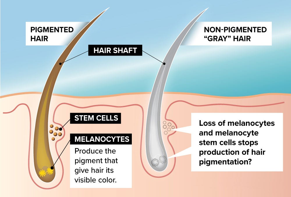 Hvad forårsager gråt hår, og hvordan man vender det